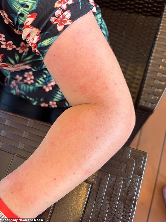 Molly suffered with itching for 24 hours but it was a result of her being covered in this soot, according to Mr Wright
