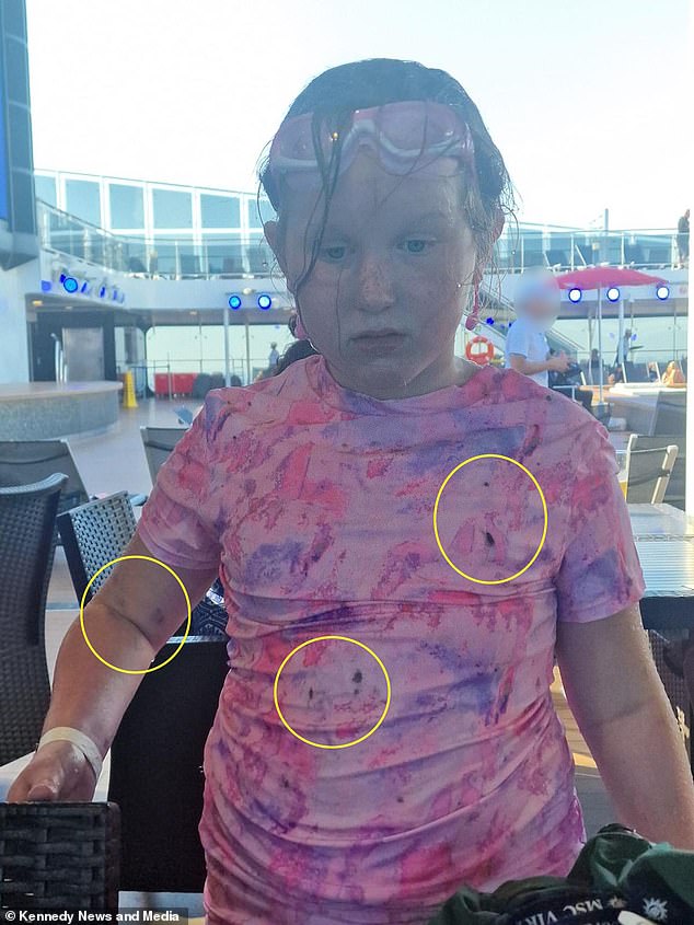 Molly, 8, was left covered in soot after it 'rained' from the ship's funnels. Mr Wright claims other guests also said they were covered in it