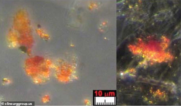 A previous study analysed blood samples taken from the shroud in 1978, which were collected using adhesive tape. This blood, according to the study, showed signs of disease, trauma and radiation