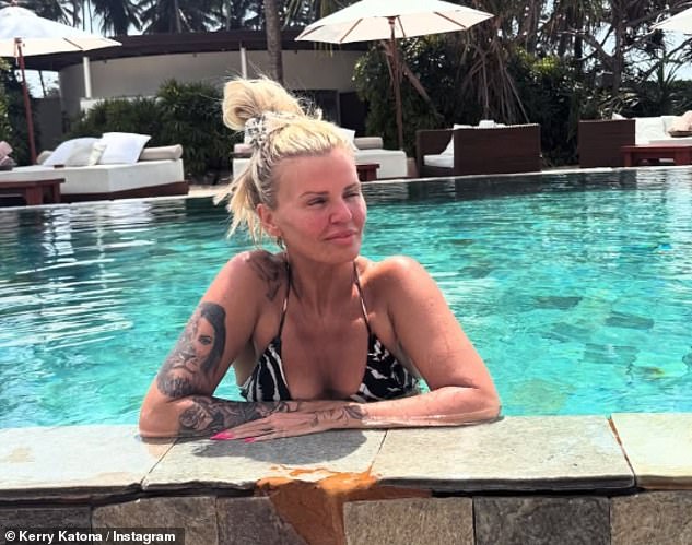 Kerry confirmed her hair loss was confined to the scalp, as other areas such as her eyebrows were not affected