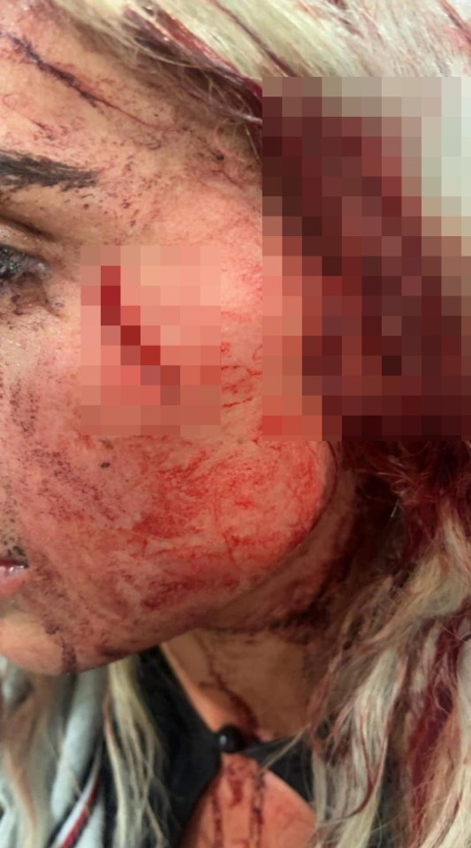 Graphic image of a woman's bloody facial injuries.