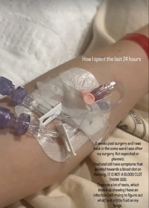 Jessie J's hospital IV drip and statement about a lung infection and fluid six weeks post-surgery.