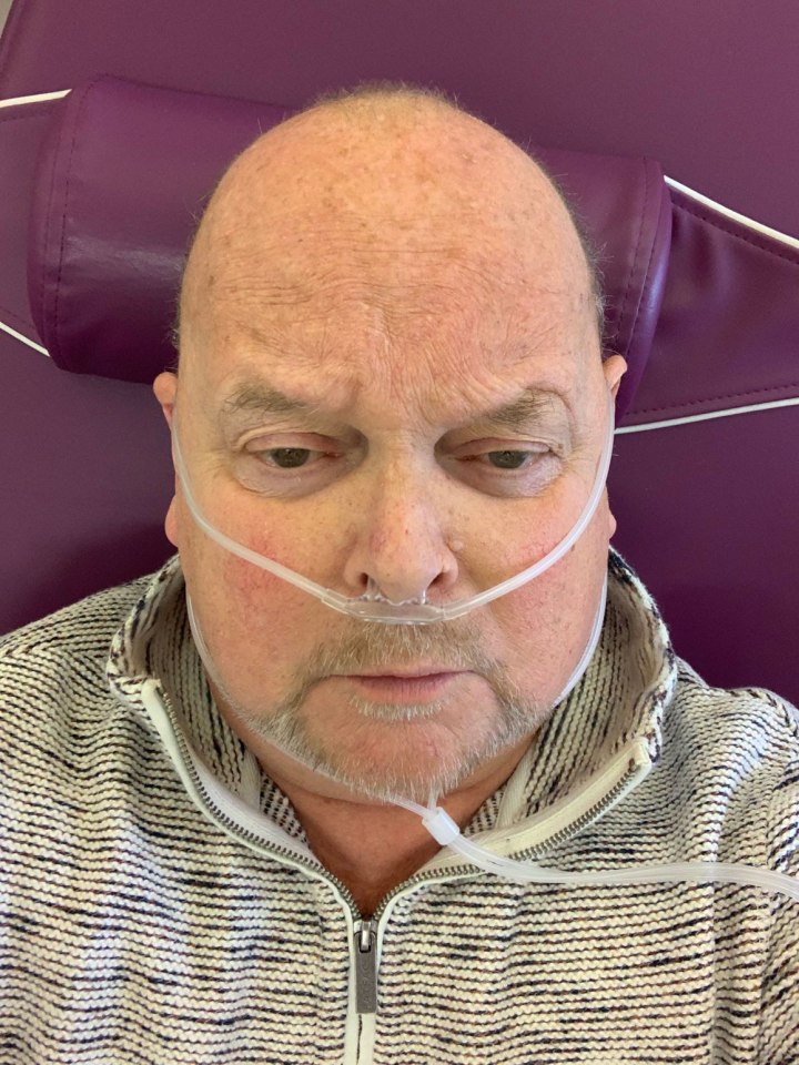 Close-up of a man with a nasal cannula.