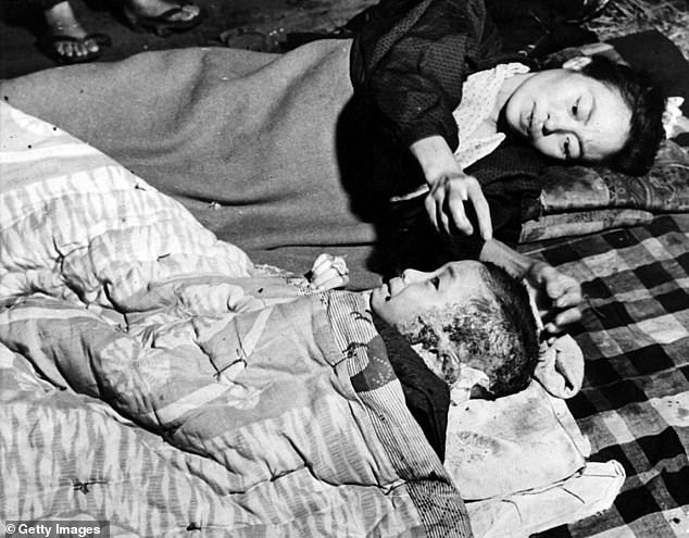 A mother, pictured on October 5, 1945, tends to her child, who was injured in the Hiroshima attack