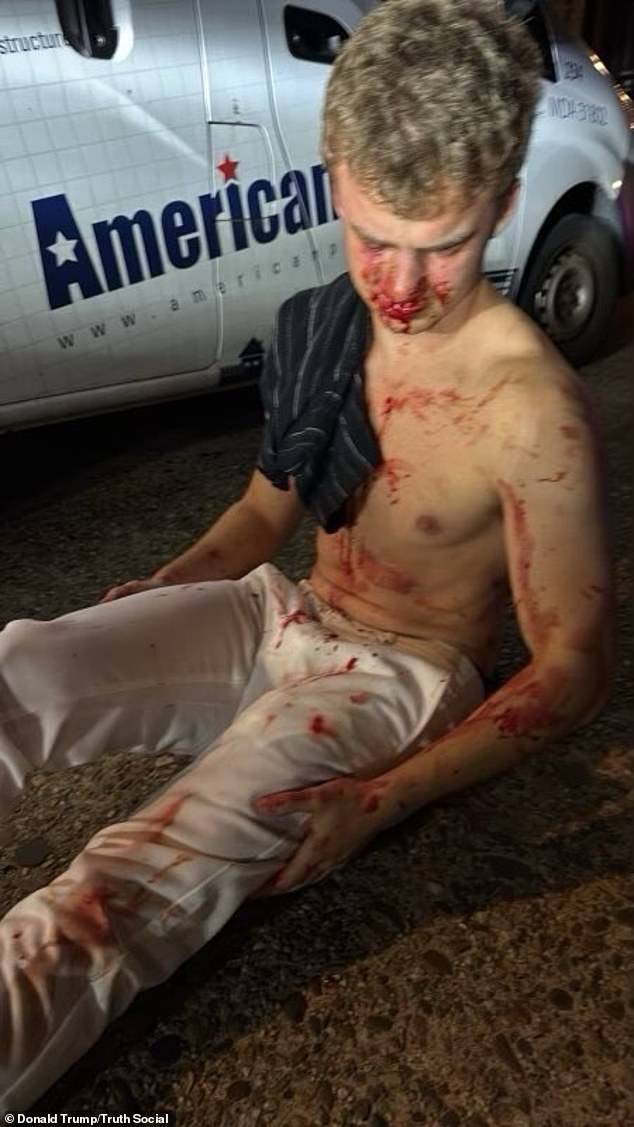 President Trump posted a photo of a man who was allegedly beat up by several people in Washington, DC