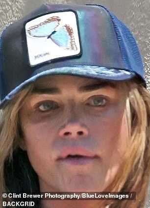 Amid the drama in personal life, Richards stepped out in Calabasas on Tuesday with a large dark shadow around her right eye and a dark mark below her chin