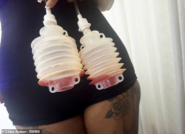A week after the op, Chloe came home to Wymondham in Norfolk ¿ but then became ¿very unwell¿ with fever and pain. When her breast began oozing discharge in early June, she made an emergency dash back to Turkey
