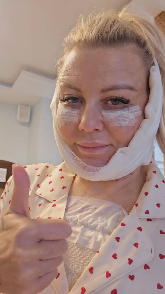 Woman post-face and neck lift surgery giving thumbs up.