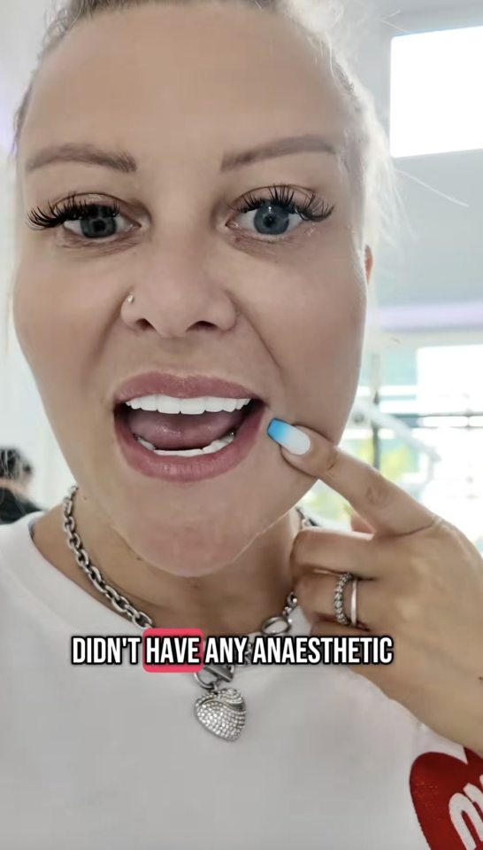 Woman showing off her new teeth after a dental procedure.