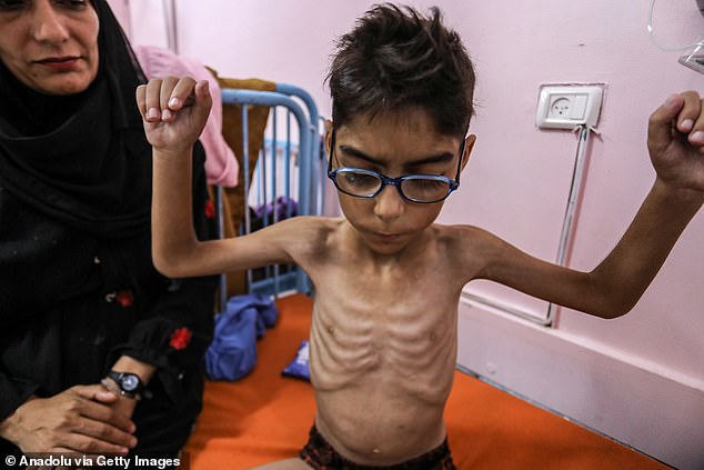 Pictures circulated online appear to show children in Gaza looking malnourished