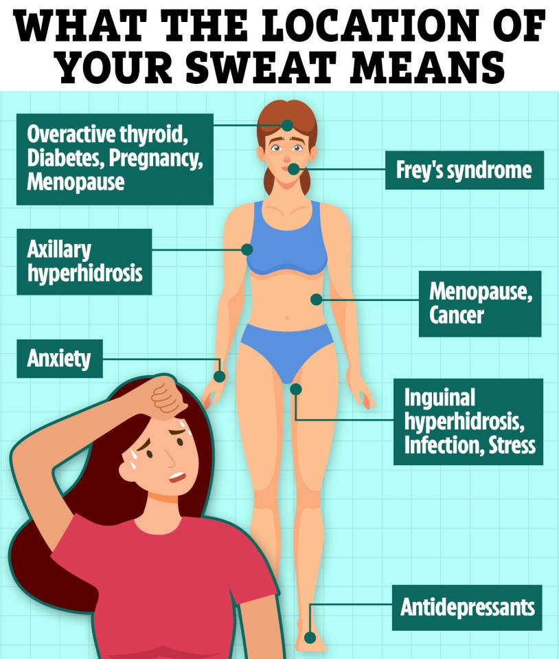 Illustration showing where sweat on the body may indicate different medical conditions.