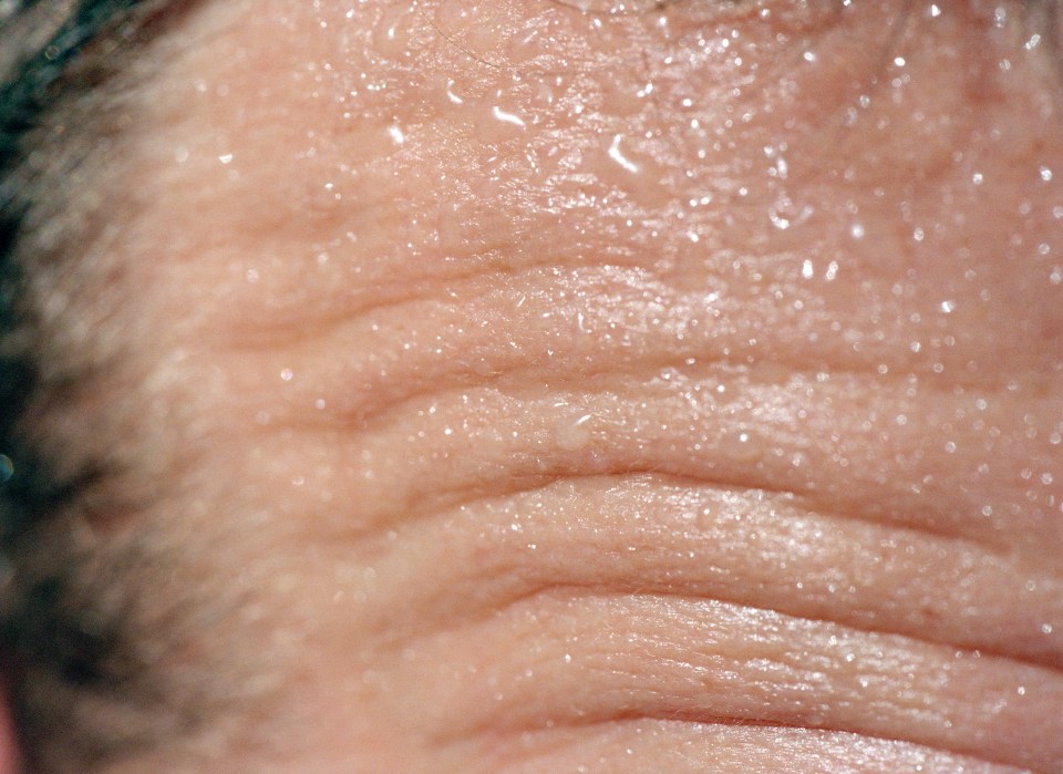 Close-up of a sweating, wrinkled forehead.