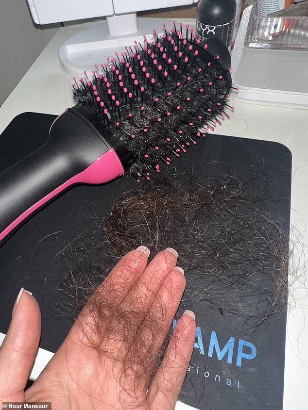 '¿I¿d run my hands through my hair and clumps would fall out,¿ said Nour