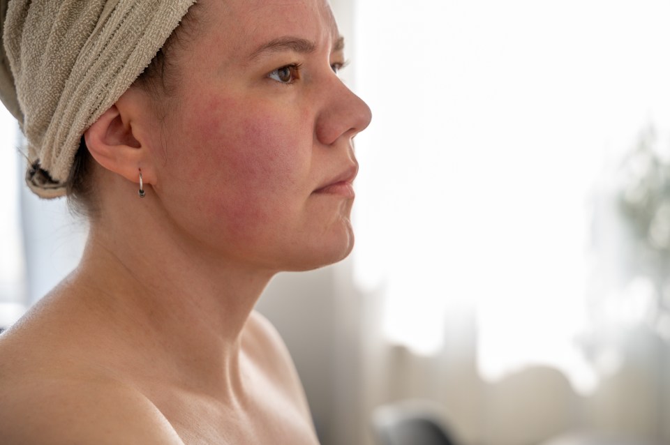 Woman with red, inflamed skin after showering.