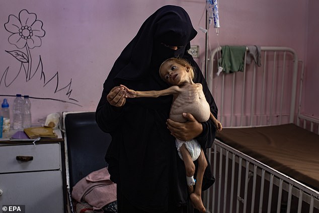 Sham Qudeih, a two-year old Palestinian child, is held by her mother at the Nasser Hospital in Khan Younis, southern Gaza Strip, 10 August 2025