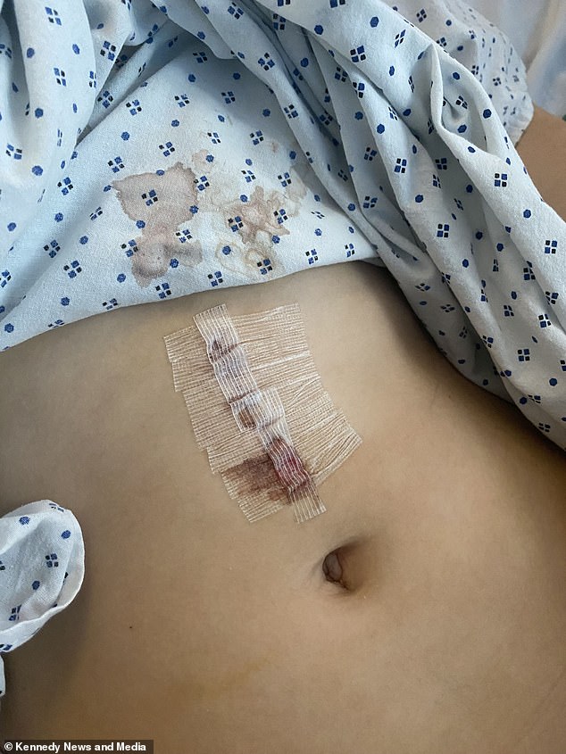 After 10 days in hospital, Erin was discharged home but her stomach may remain oversized for years