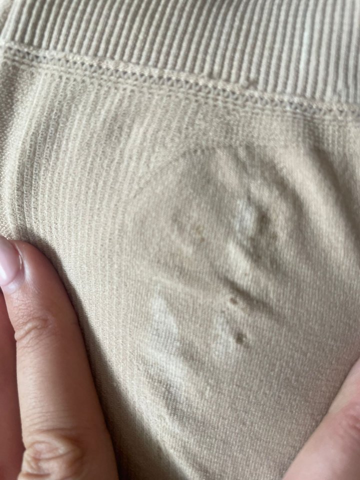 Close-up of beige shorts with a damaged area, allegedly caused by burns.