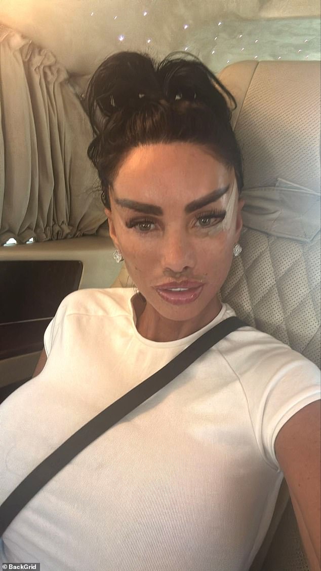As Princess' show has aired, Katie has been recovering from yet more facial surgery. During her time at a Turkish clinic, Katie underwent a lip lift correction, brow lift, and eye lift