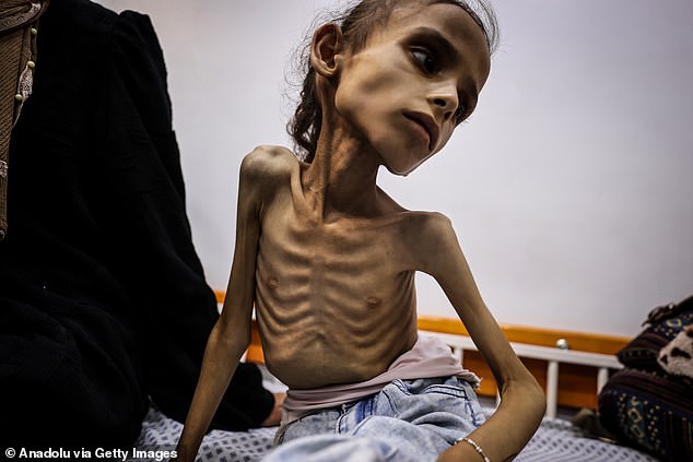 But Israel insists that Gaza is not facing starvation and says Hamas is responsible for the looting of aid. Pictured: Maryam Duvvas, 9, is reported to be in critical condition due to severe malnutrition in Gaza City