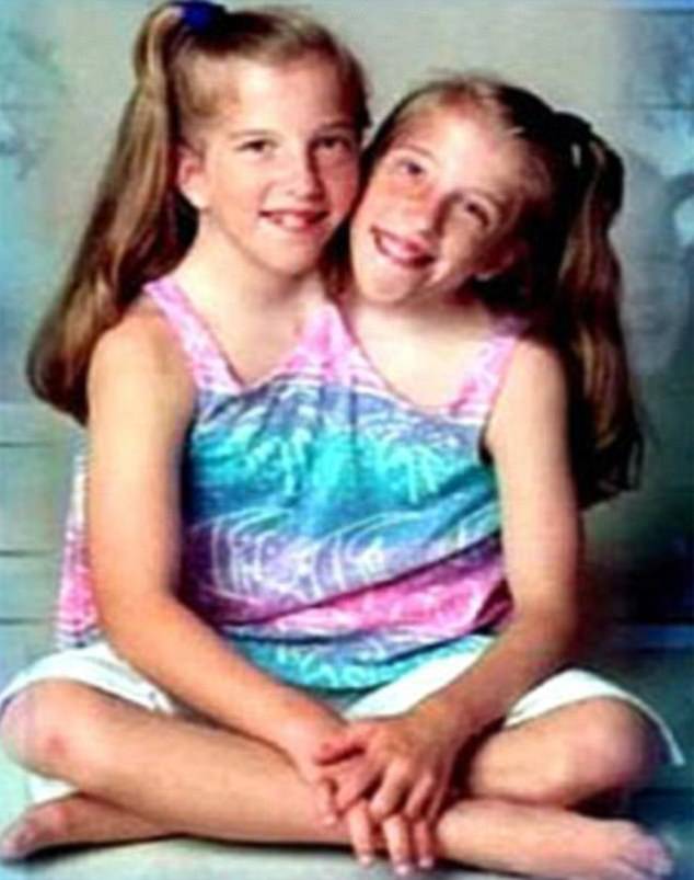 Abby and Brittany are dicephalic conjoined twins - meaning they have two heads but share one body