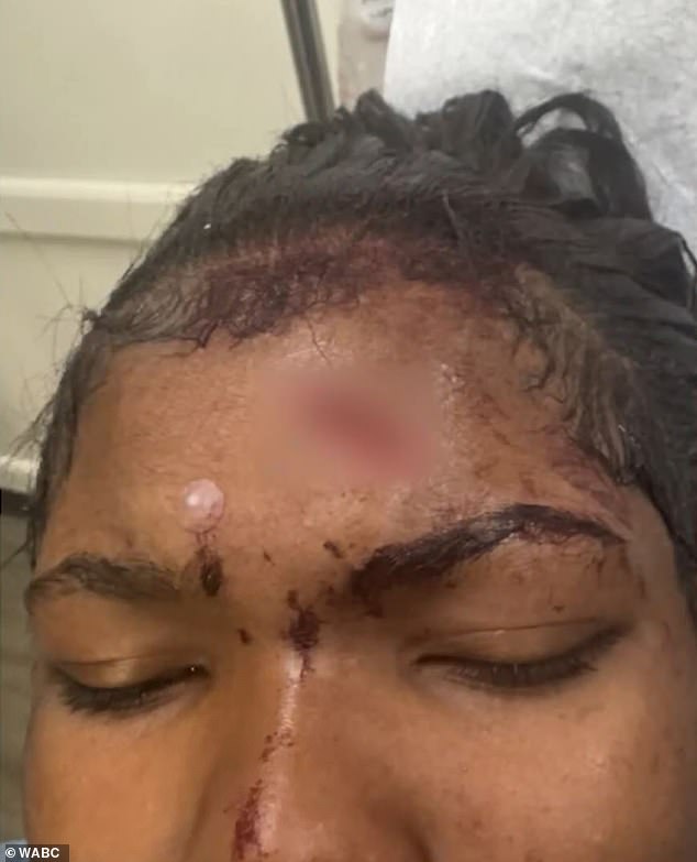 The teen said she is now 'shaking all the time' after the attack left her with 17 stitches - and admits she may never use the cup brand again because of the distress
