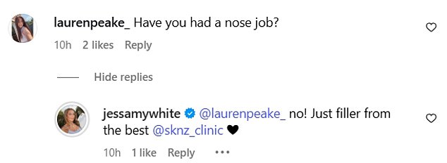 One fan was quick to take to the comments to ask, 'Have you had a nose job?' Jess was quick to hit back and confirm, 'No! Just filler from the best @sknz_clinic'