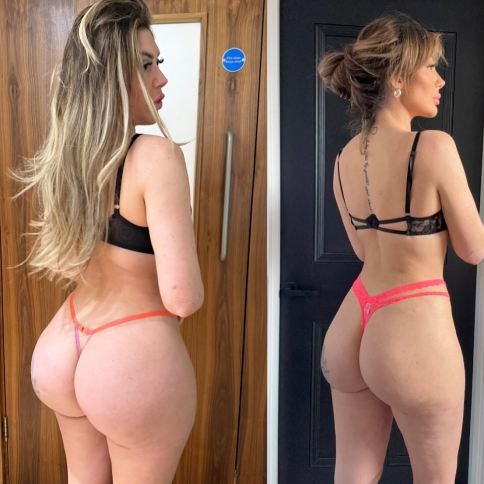 Before and after photos showing BBL removal.