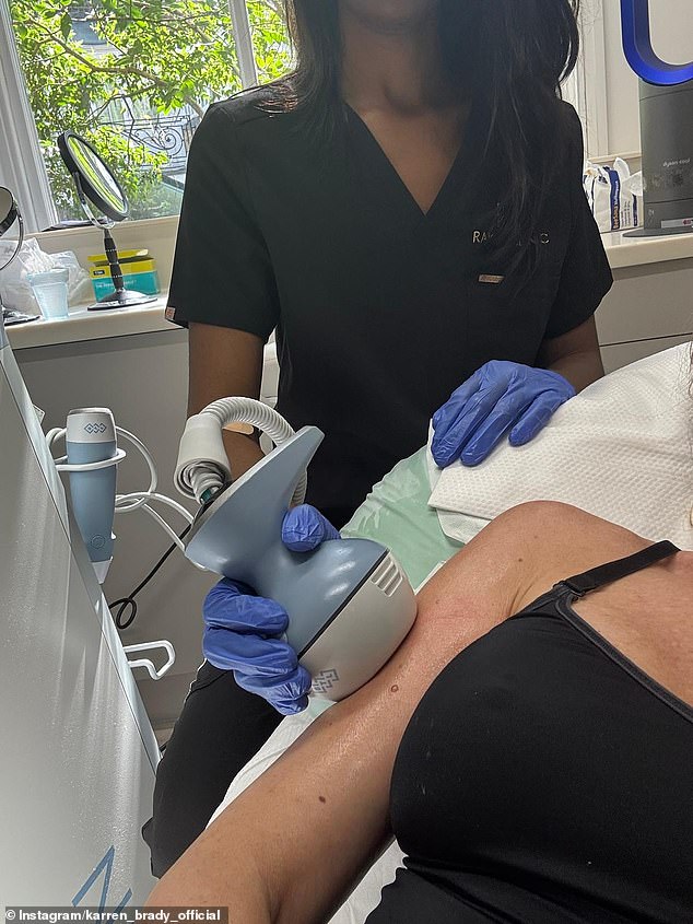 Over the weekend, Karren said that the Exion skin treatment she received (pictured) has allowed her to feel comfortable wearing short-sleeved dresses