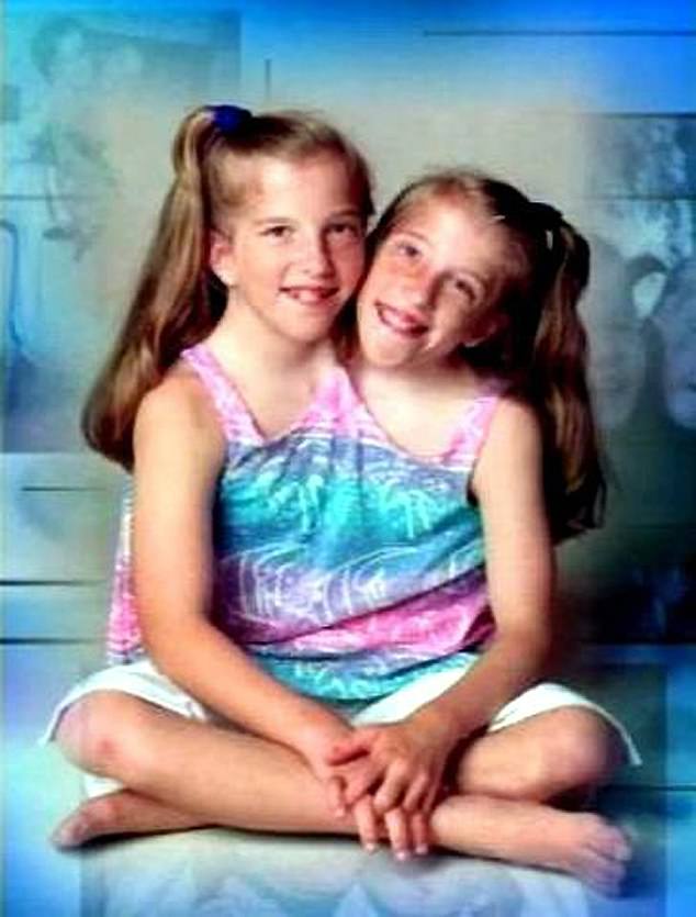Abby and Brittany have two heads, two brains, two spinal cords, and two hearts, which are part of a shared circulatory system