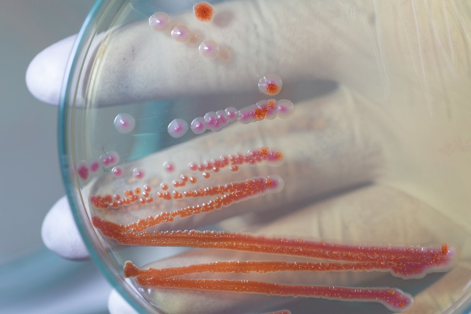 Laboratory petri dish with Serratia marcescens bacterial colonies.