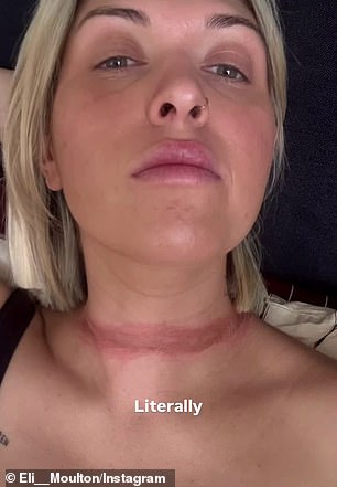 The mother-of-two told her Instagram followers on Sunday she was on her way home after an event when the accessory got tangled beneath her car and was torn off