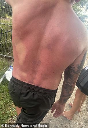 He described the moment of impact 'like hitting concrete'
