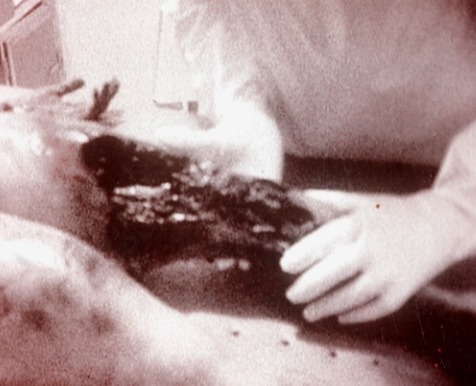 Collage of alleged Roswell alien autopsy stills.