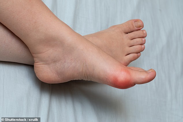 There are more than 130 types of bunion surgery, each with pros and cons. A surgeon should explain why a specific procedure is being offered, says Dr Ellie