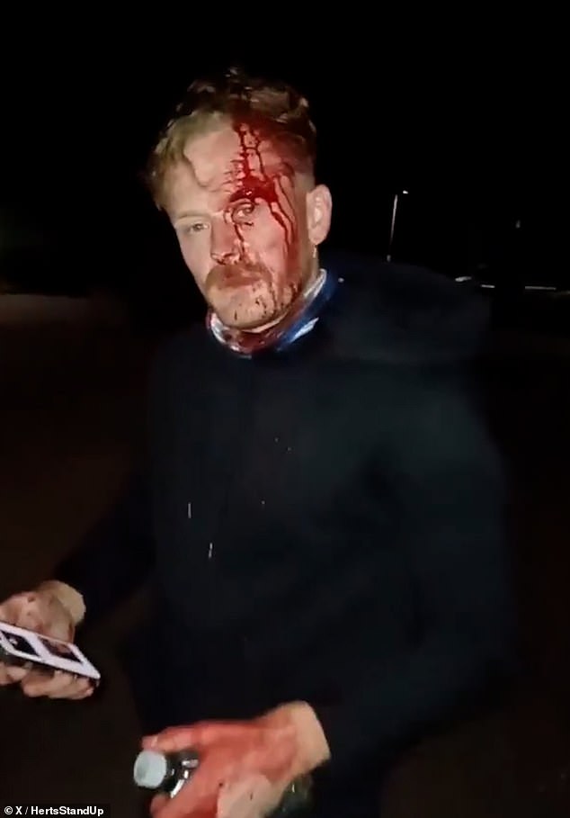 The incident happened just after midnight on Saturday as the victim, named Louis, was out with a group putting up St George's flags around their local area