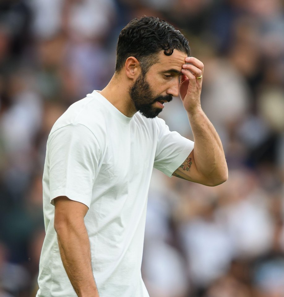 Manchester United manager Ruben Amorim looking distressed.
