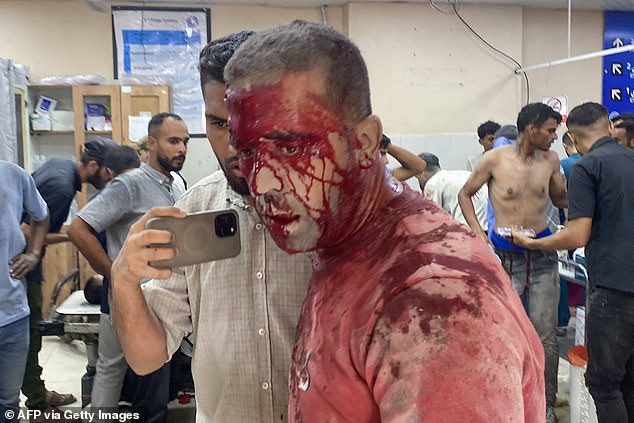 Photographer Hatem Omar, who was injured in Israeli strikes on Nasser hospital in Khan Yunis in the southern Gaza Strip on August 25, 2025