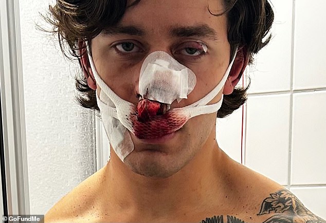 John Rudat (pictured) , 21, was left bloodied and battered after trying to stop two women from being violently assaulted on German public transit