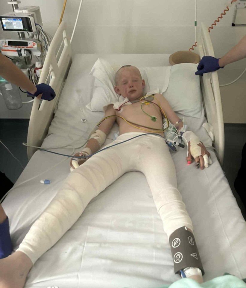 A boy in a hospital bed with bandages on his legs and arms.