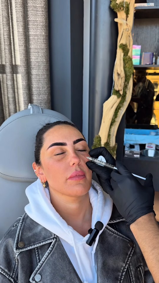 Woman receiving facial filler injections.