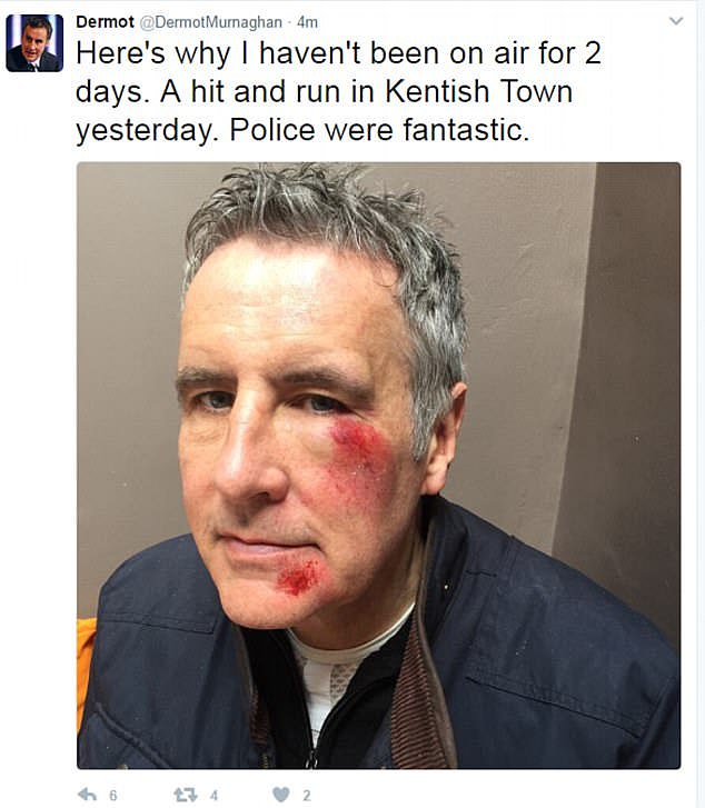 Dermot, a keen cyclist, was a victim of a 'hit and run' in 2016 when he was knocked off his bike