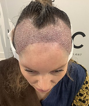 Katie undergoes treatment