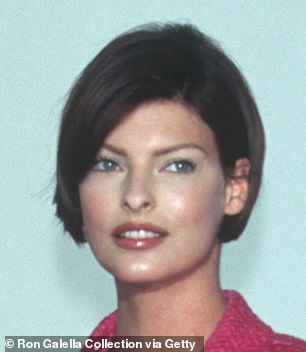 Linda, pictured in 1995, explained that in 2021 she had been left 'permanently deformed' after trying CoolSculpting
