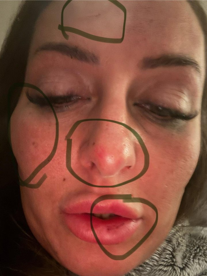 Close-up photo of a woman's face showing injuries consistent with assault.