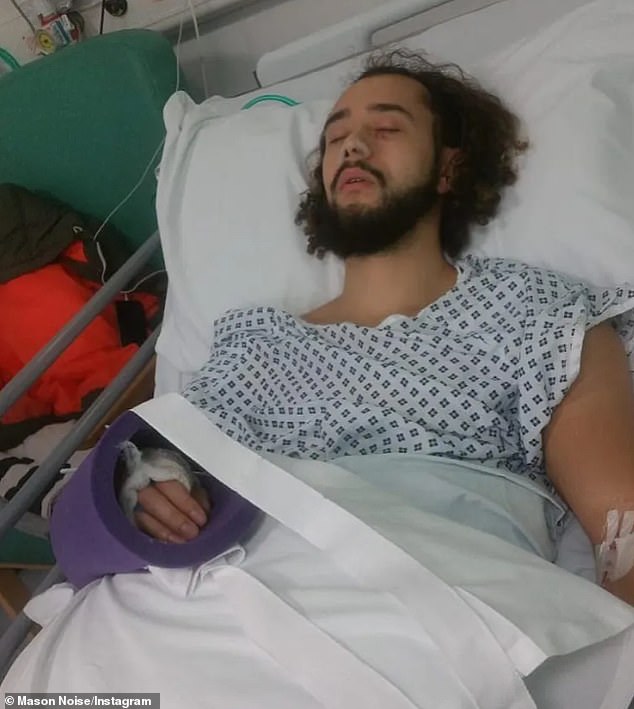 Mason previously told how he feared he would die after he contacted sepsis following a bar fight with a stranger in 2019