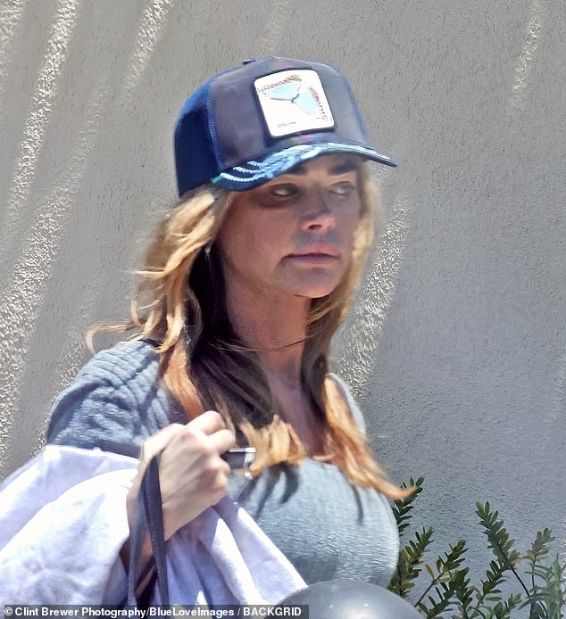 Denise Richards sparked concern as she stepped out with an apparent black eye this week just days after getting confronted by cops at her ex Aaron Phypers' home