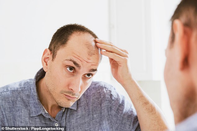 It's estimated that around a quarter of men in their 20s now show signs of balding ¿ by the age of 50, that figure rises to 85 per cent of men