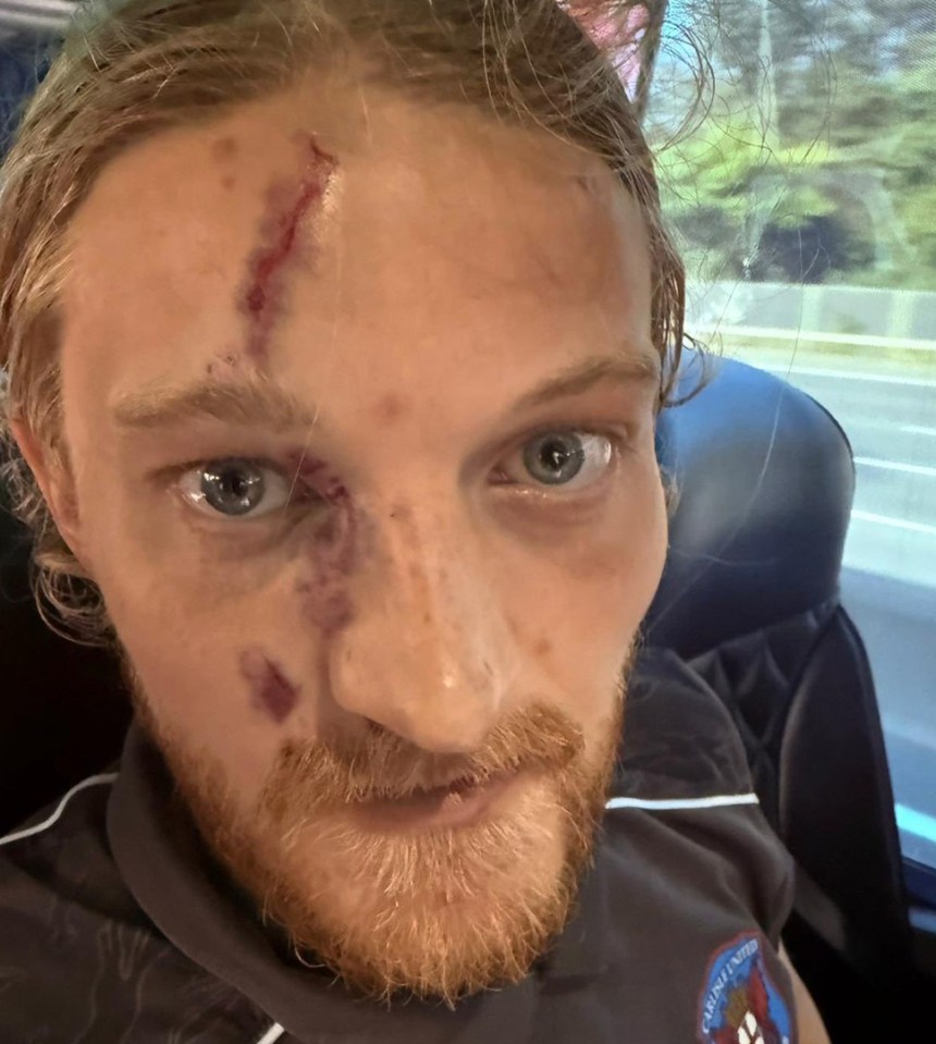 Soccer player's injured face next to a photo of a collision during a game.