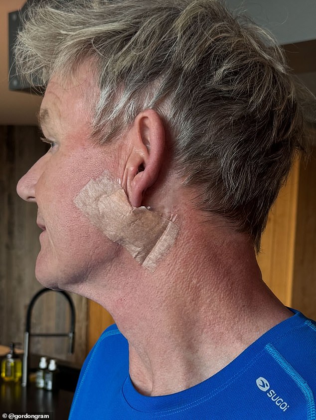 Gordon Ramsay has revealed he suffered a terrifying cancer scare