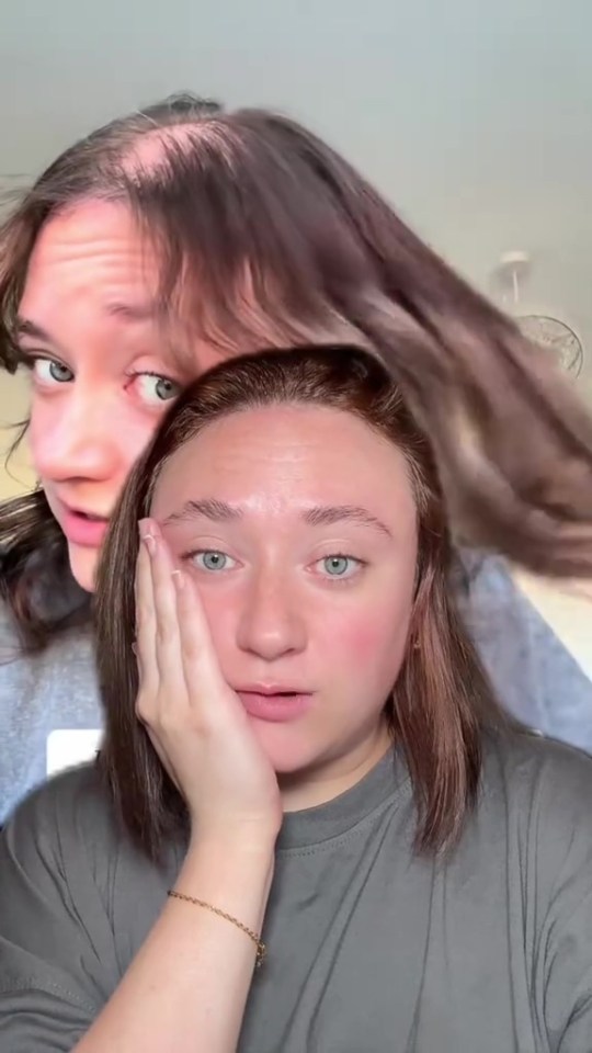Two women, one with thinning hair, the other with a full head of hair.